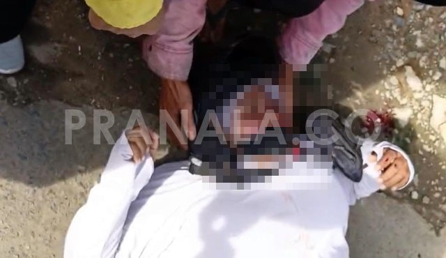 Diduga Kurang Fokus, Emak-Emak Tabrak Mobil Parkir di Km 3 Bontang, Alami Luka Serius