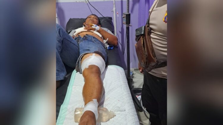 Gara-Gara Ucapan “Apa Kamu Lihat-Lihat”, Duel Berdarah di Jalan