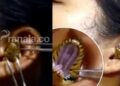 Bikin Ngeri, Ular Berbisa Bersarang di Telinga Wanita Ini