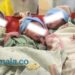 Bayi Kembar Tiga Berhasil Lahir di RSUD Panglima Sebaya Paser