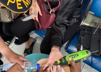 Cincin Sulit Dilepas dari Jari, Warga Bontang Ini Minta Tolong ke Damkartan Bontang