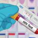 Ada 180 Kasus HIV Baru di Samarinda, Begini Fakta Sebenarnya
